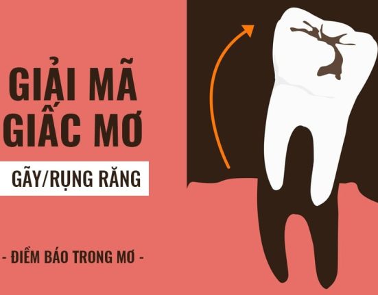 Mơ rụng răng, gãy răng có nghĩa gì? Đây là điềm lành hay dữ