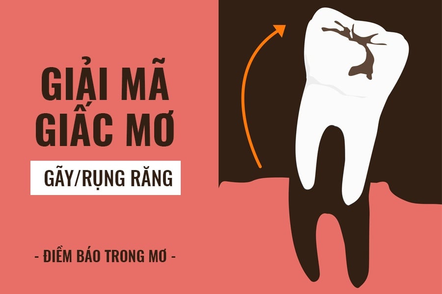 Mơ rụng răng, gãy răng có nghĩa gì? Đây là điềm lành hay dữ